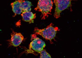 Descubren la causa de la reaparición del tumor linfático y su resistencia terapéutica