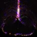 Identifican cambios genéticos en el cerebro que aceleran el envejecimiento