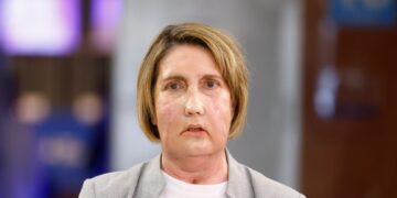 Trasplante facial pionero abre nuevas posibilidades en medicina reconstructiva